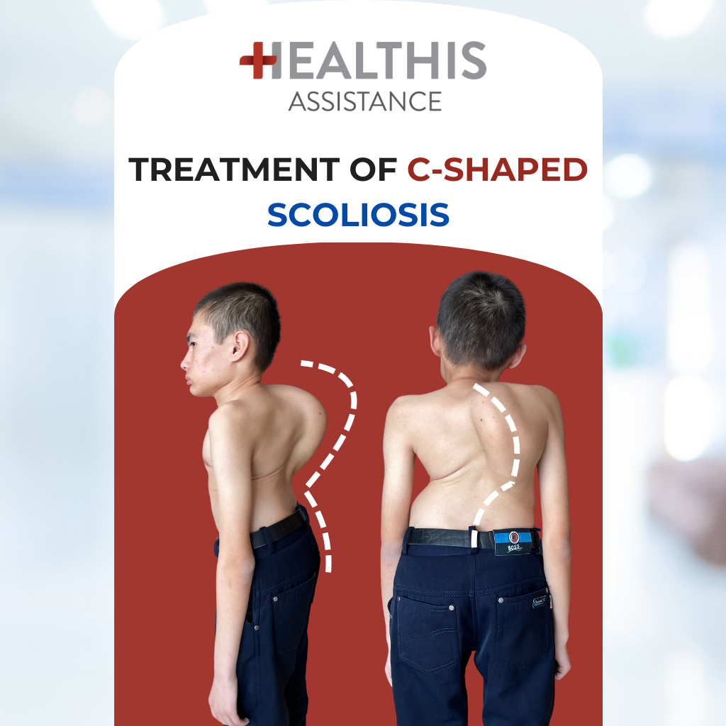 SCOLIOSIS Treatment – Patient story