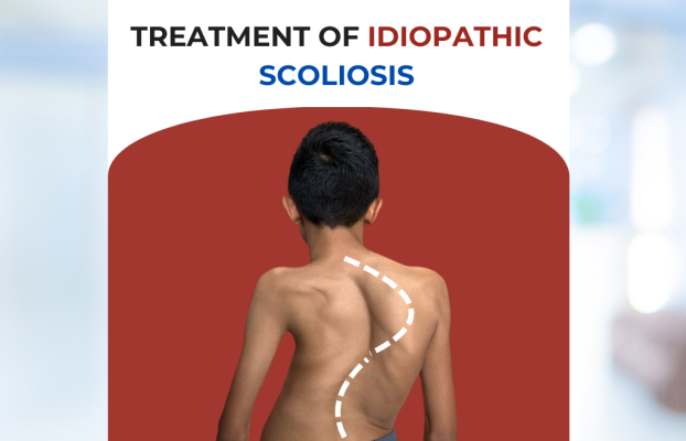 Сколиоз — История Пациента