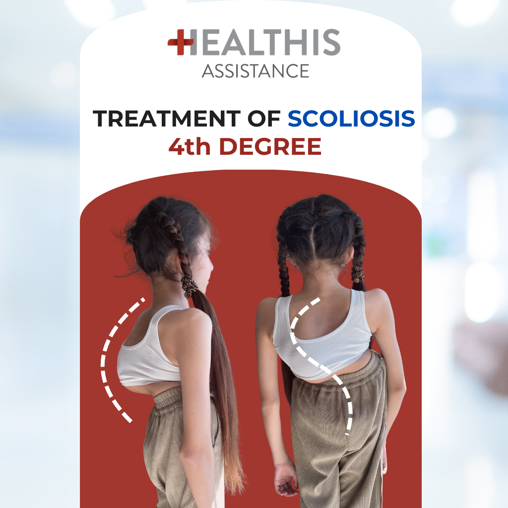 SCOLIOSIS Treatment – Patient story